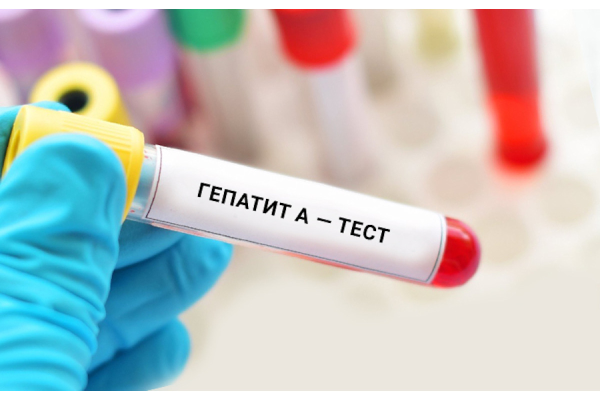 У Броварах зафіксували випадок інфікування вірусним гепатитом А