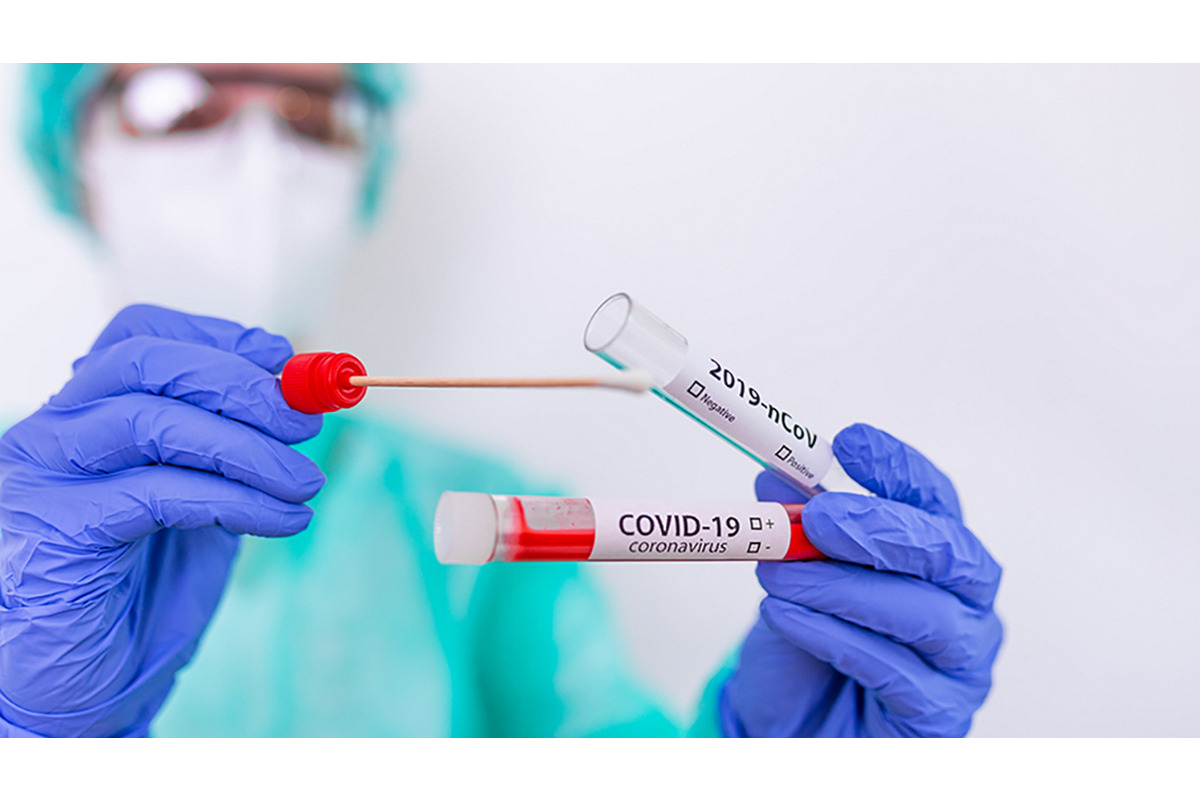 На Київщині різко зросла кількість нових випадків COVID-19