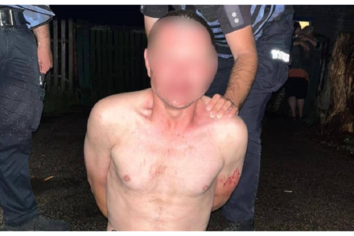 На Броварщині конфлікт між друзями завершився кривавою різаниною (ФОТО, ВІДЕО)