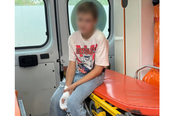 У Бучанському районі підліток отримав опіки при контакті з невизначеними предметами