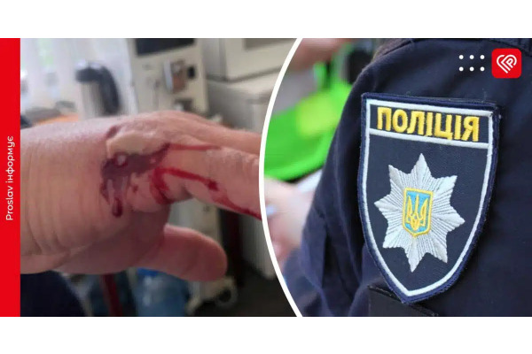 Активістка вкусила міського голову Переяслава: мер вакцинувався, поліція відкрила справу