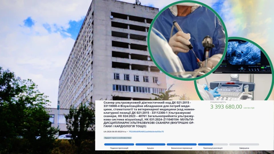 Білоцерківська лікарня №2 придбає ультразвуковий сканер за понад 3 млн грн