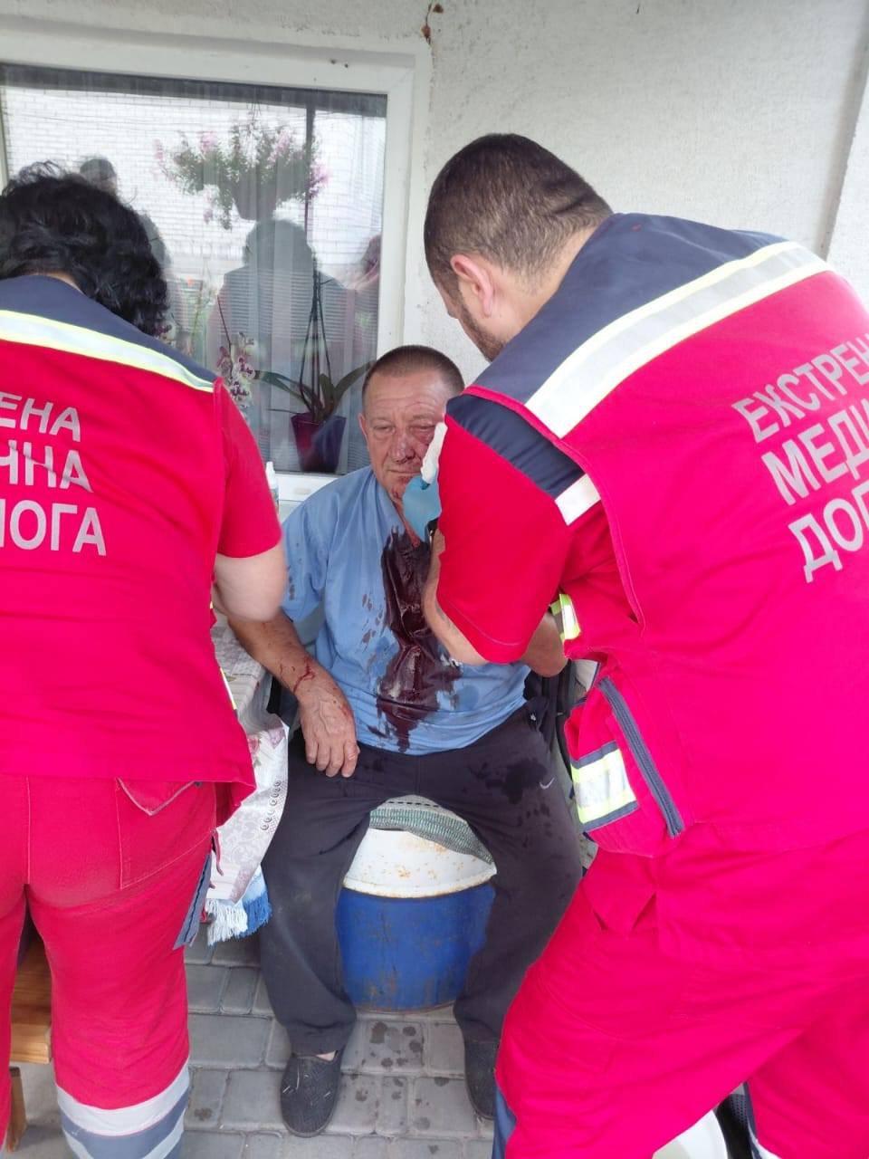 Жорстоке побиття в селі Гребінки: постраждав батько загиблого нацгвардійця